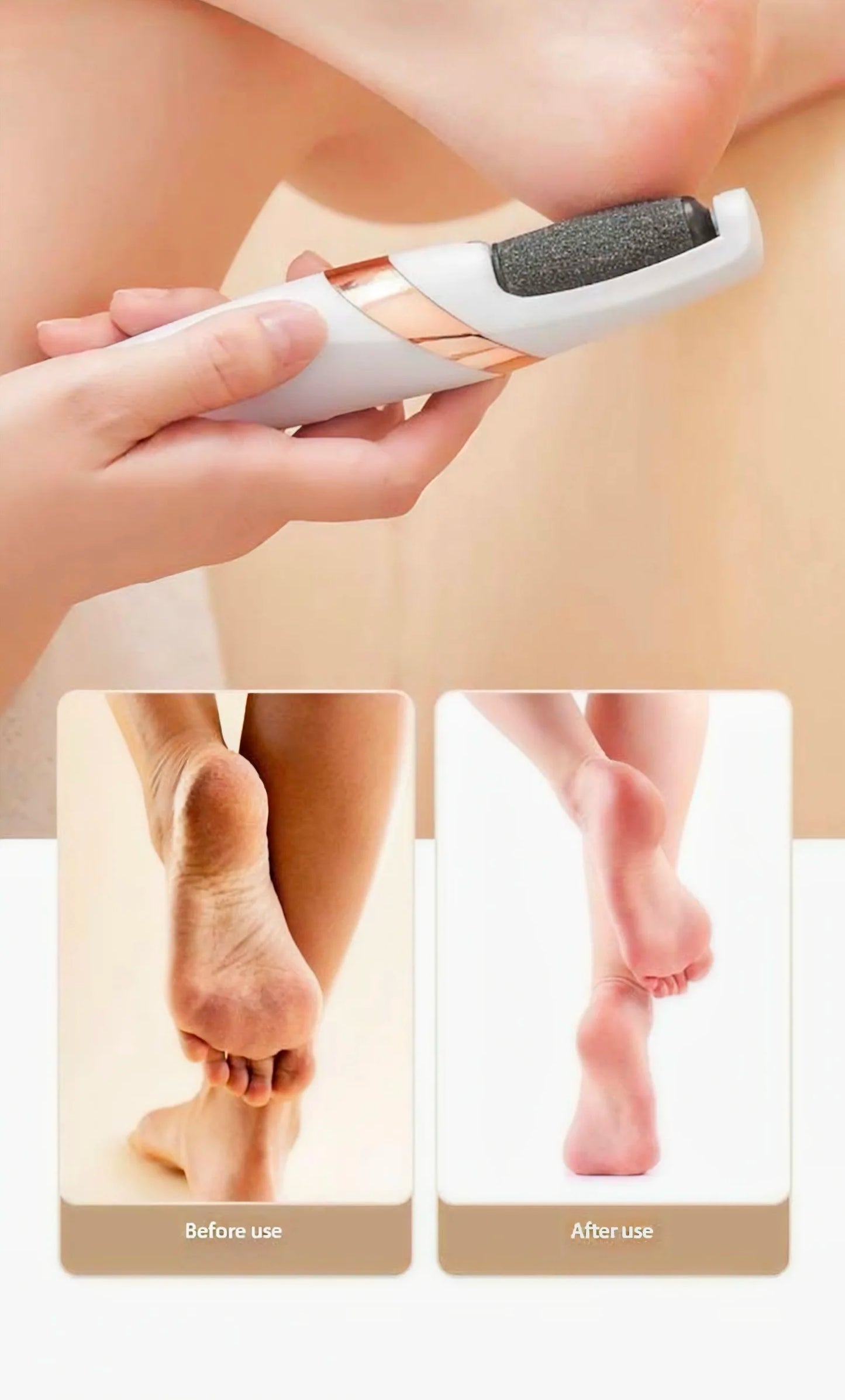 Smooth Pedicure Wand for Feet Electric Foot Callus Remover Rechargeable Pedicure Tools for Feet Callus Removal Tool Best Device